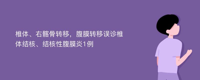 椎体、右髂骨转移，腹膜转移误诊椎体结核、结核性腹膜炎1例